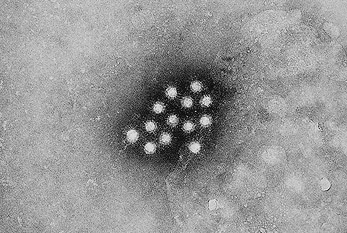 Réception d'un virus de l'hépatite par un microscope électronique à balayage.