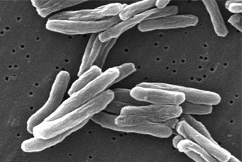 Bacilles tuberculeux sous un microscope électronique à balayage,